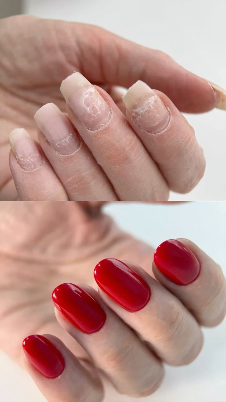 Antes e depois — Unhas danificadas → esmaltação em gel vermelha impecável